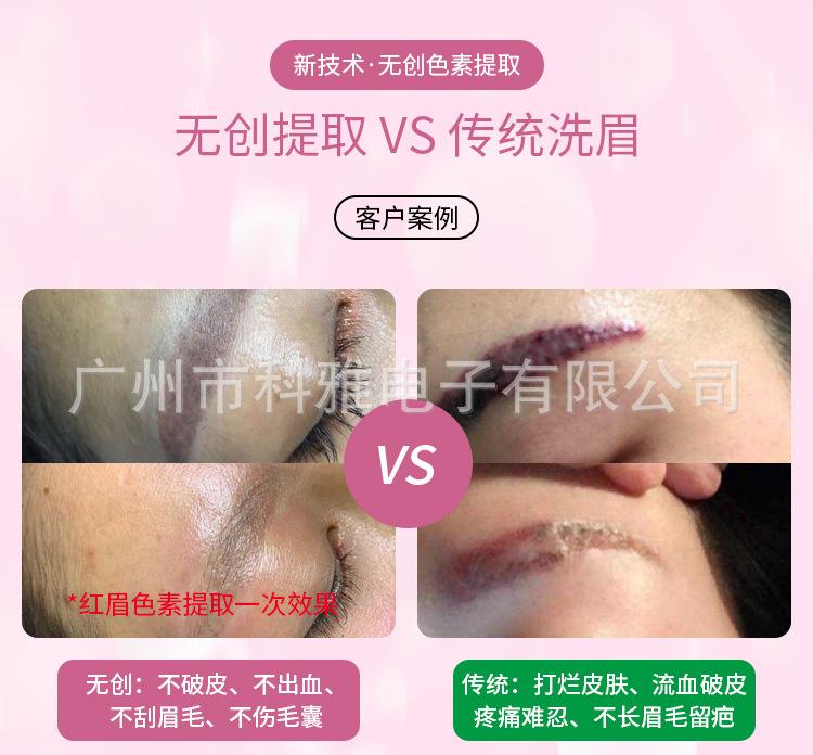 黑科技洗眉和激光洗眉的区别(手工洗眉好还是激光洗眉好)